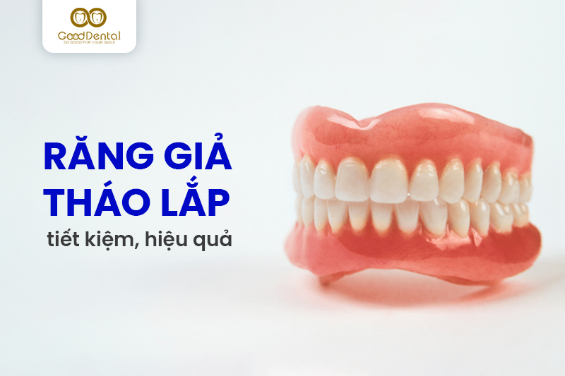 Răng giả tháo lắp – Giải pháp tiết kiệm tối ưu cho người mất răng