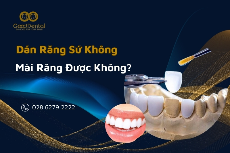 Dán Răng Sứ Không Mài Răng Được Không?