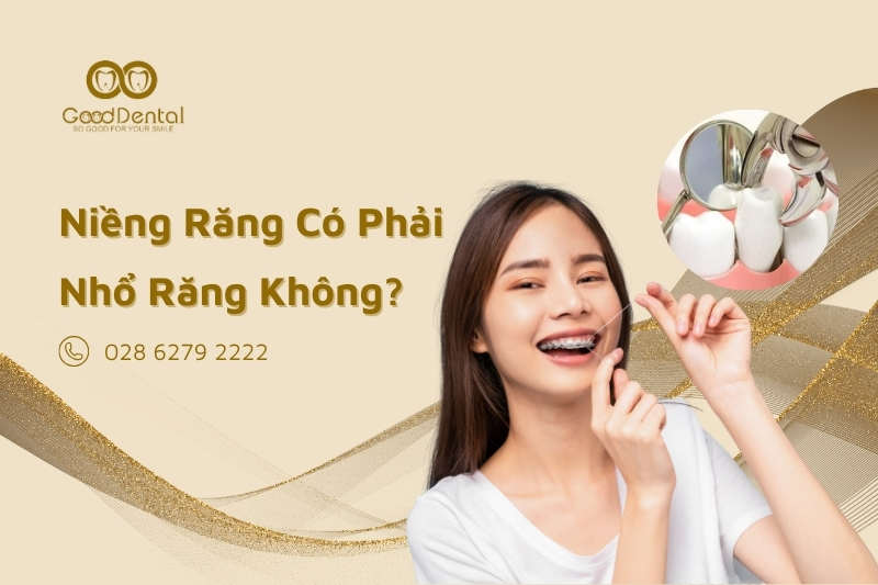Niềng Răng Có Phải Nhổ Răng Không? Các Trường Hợp Phải Nhổ Răng Trước Niềng