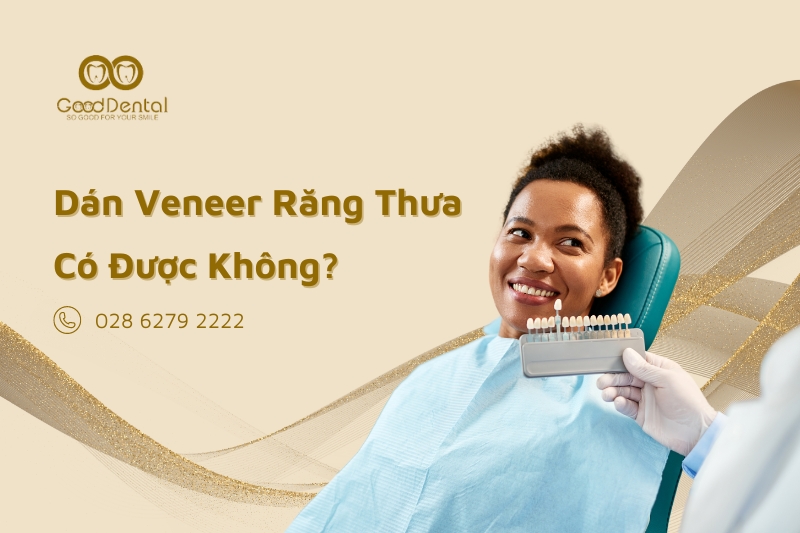 Dán Veneer Răng Thưa Có Được Không?