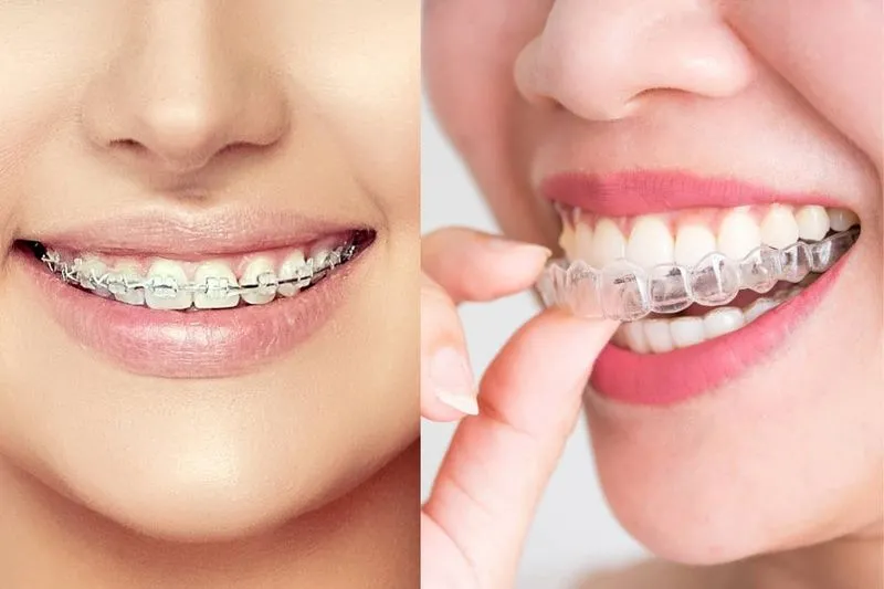 Ưu Điểm Vượt Trội Của Invisaglin