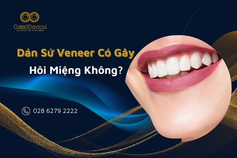 Dán Sứ Veneer Có Bị Hôi Miệng Không? Sự Thật Là;