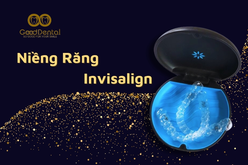 Liệu Pháp Niềng Răng Invisalign Hiệu Quả Đến Đâu?