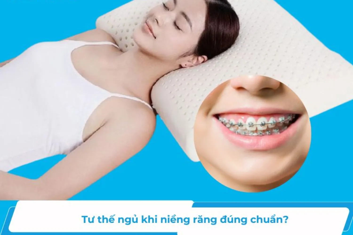 3 tư thế ngủ khi niềng răng