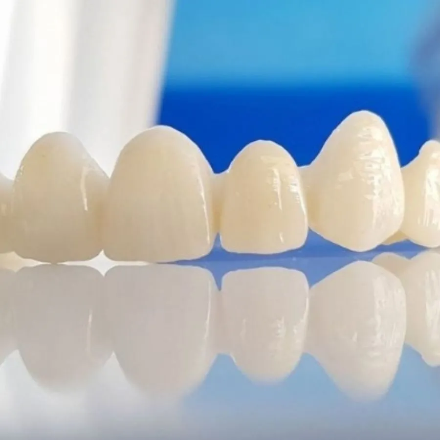 Phân biệt các loại phục hình răng sứ: Mão sứ, Veneer, Cầu răng, Implant – Giải pháp nào phù hợp với bạn?