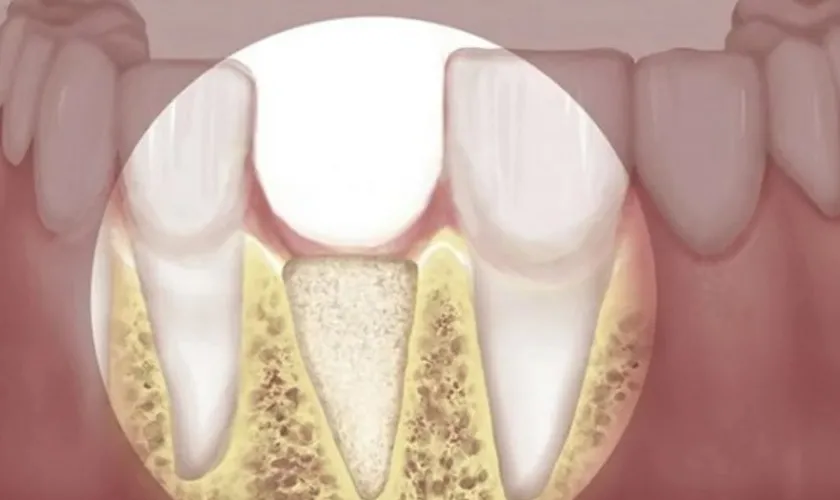 Những Ưu Điểm Nổi Bật Của Phục Hình Răng Sứ Bạn Nên Biết