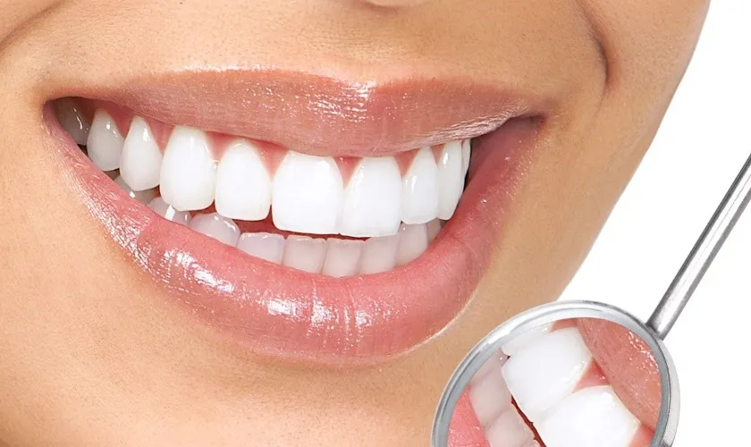 Những Ưu Điểm Nổi Bật Của Phục Hình Răng Sứ Bạn Nên Biết