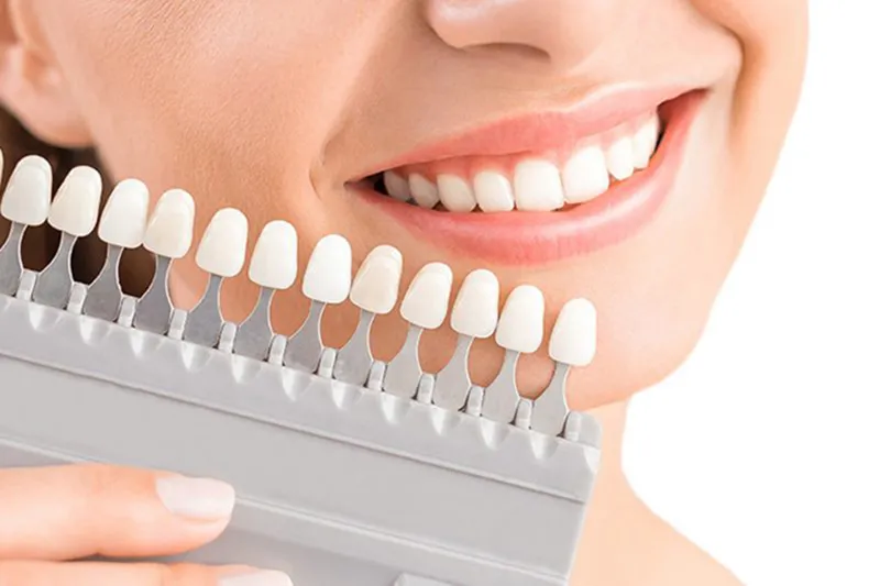 Những Ưu Điểm Nổi Bật Của Phục Hình Răng Sứ Bạn Nên Biết